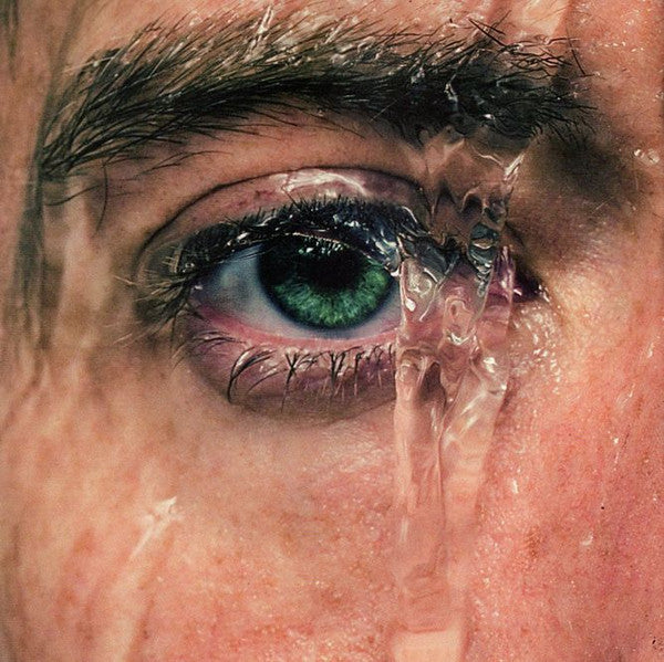anhedonia