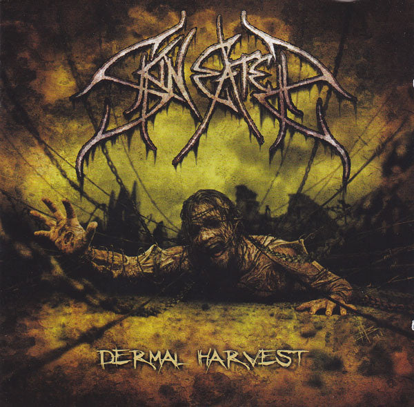 dermal-harvest