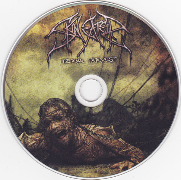 dermal-harvest