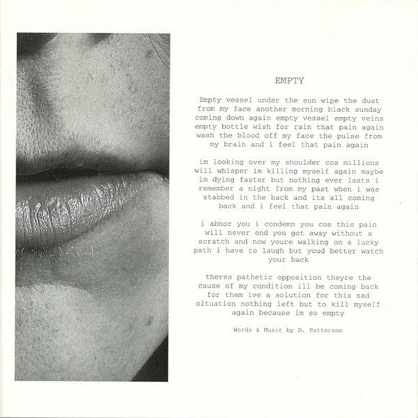alternative-4