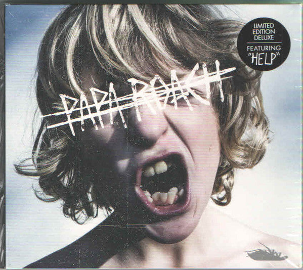 crooked-teeth