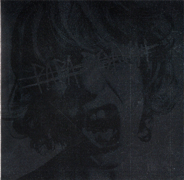 crooked-teeth