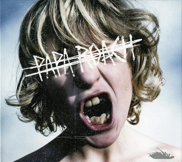 crooked-teeth