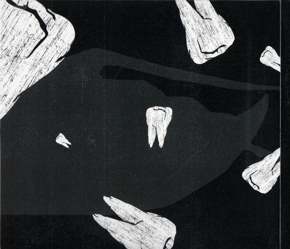 crooked-teeth