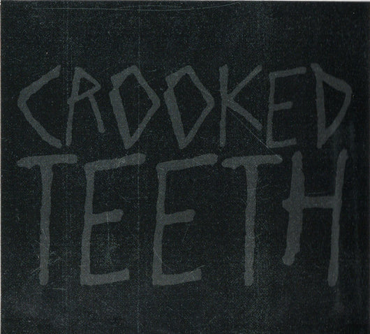 crooked-teeth