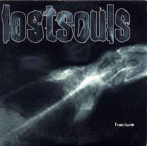 fracture