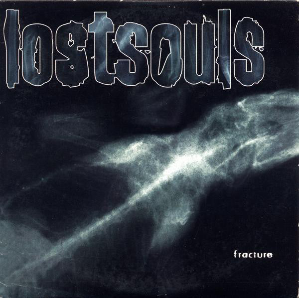 fracture