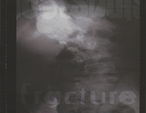 fracture