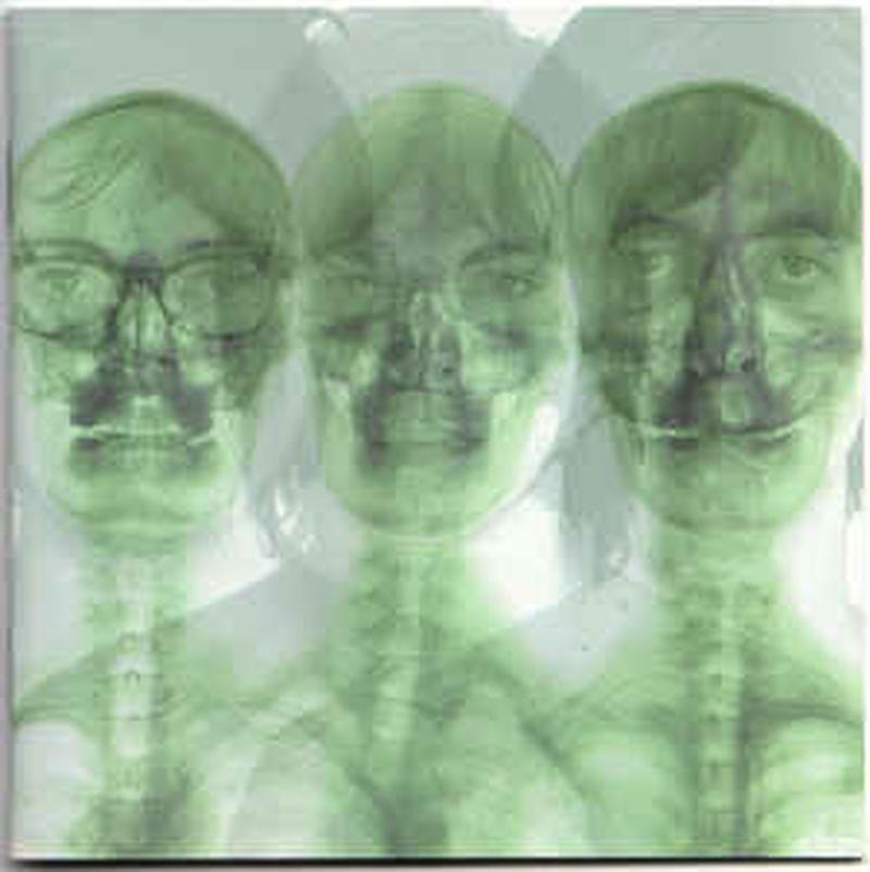 supergrass