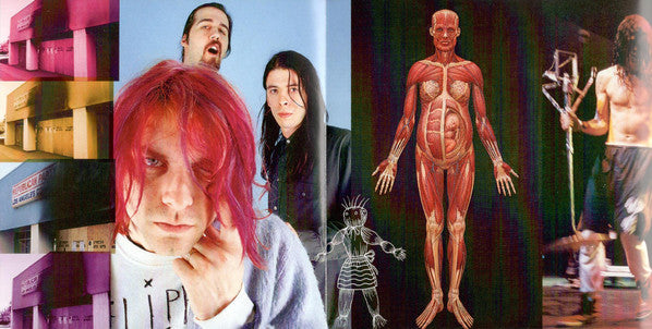 in-utero