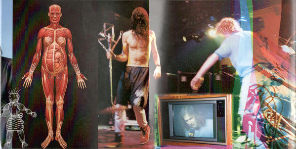 in-utero