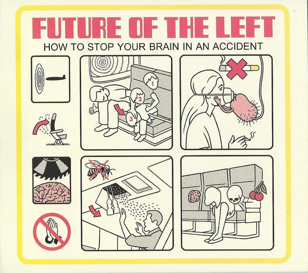 how-to-stop-your-brain-in-an-accident